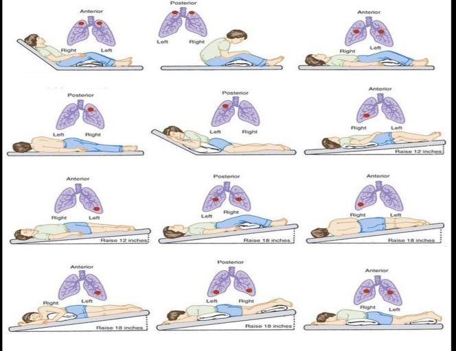 Concept about Postural Drainage