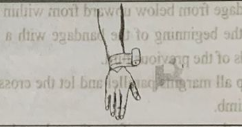 ROLLER BANDAGE | CHAPTER 22 | Fundamentals of Nursing