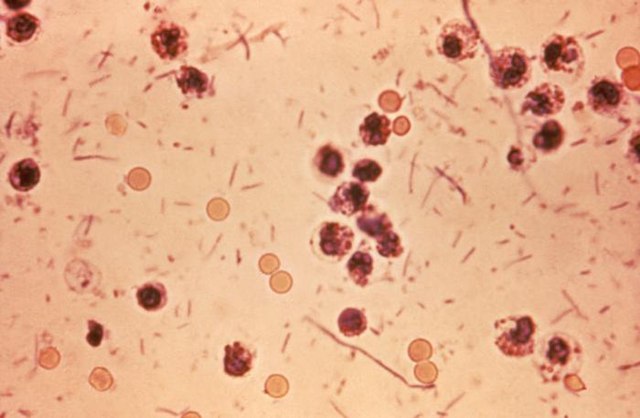 All About Shigella