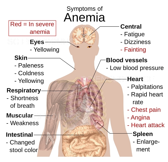 Concept of Anemia | CHAPTER-10 | Medical and Surgical Nursing