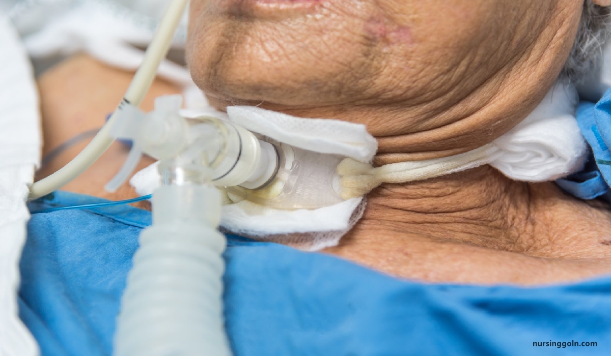 Tonsillitis and Tracheostomy | CHAPTER-10 | Medical and Surgical Nursing