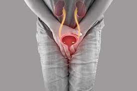 Urinary Incontinence | Chapter 7 | Medical And Surgical Nursing