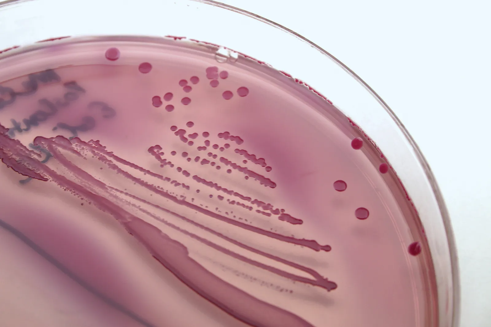Urinary Tract Infection (UTI) | Chapter 7 | Medical And Surgical Nursing