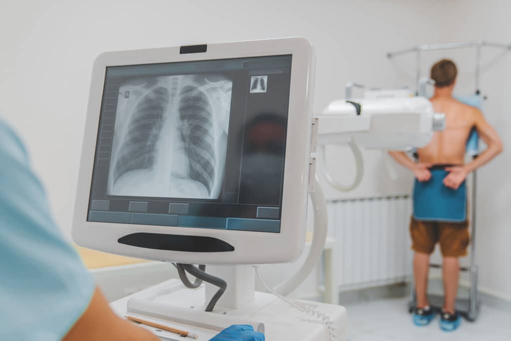 definition of x rays