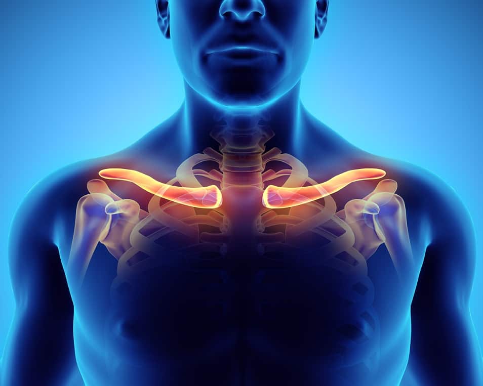 Fracture of clavicle | CHAPTER 5 | Orthopedic Nursing