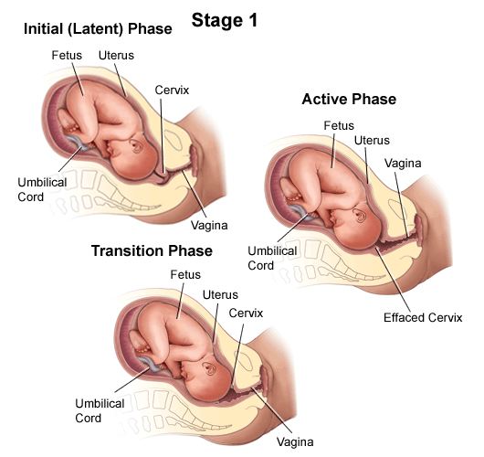 First Stage Of Labor | Chapter 13 | Midwifery For Diploma In Nursing