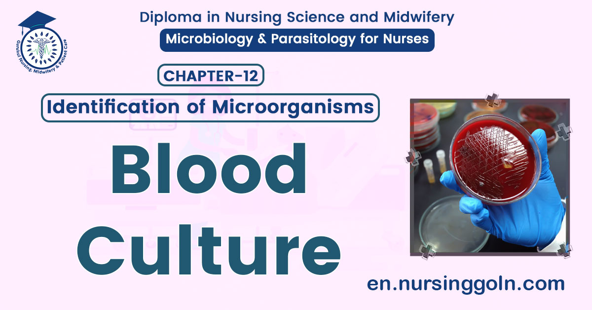 Concept about Blood Culture
