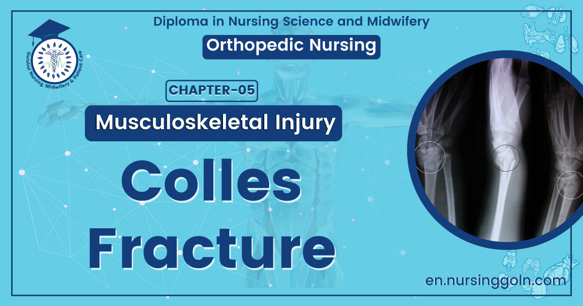 Colles fracture | CHAPTER 5 | Orthopedic Nursing