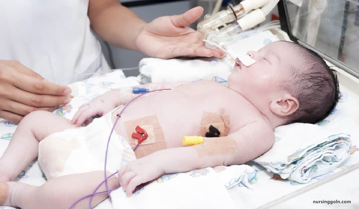 Common infections of neonate | CHAPTER 18 | Pediatric Nursing