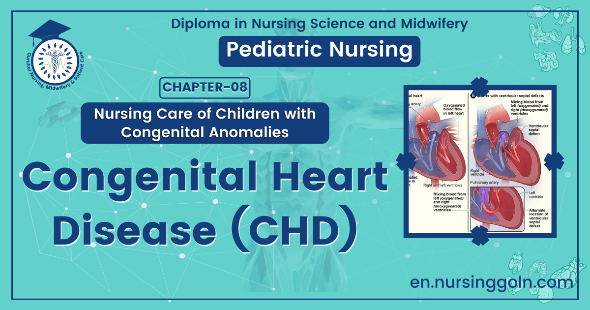Congenital heart disease (CHD) | CHAPTER 8 | Pediatric Nursing