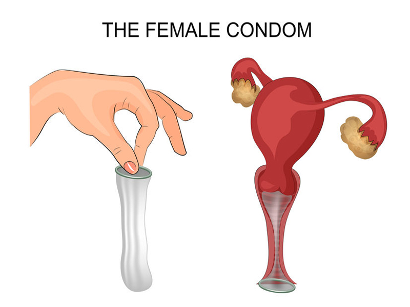 Concept of Condom