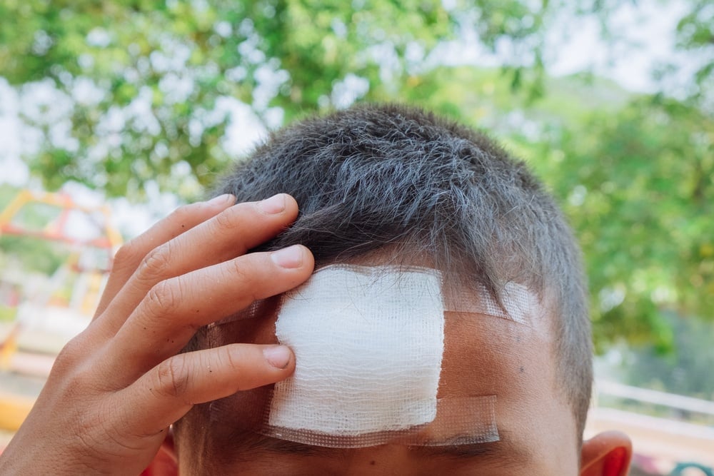 Head Injury | CHAPTER 22 | Orthopedic Nursing
