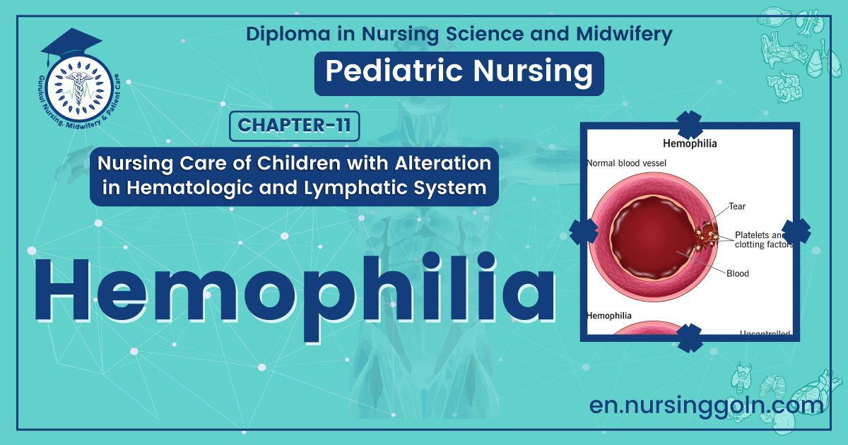 Concept about Hemophilia | CHAPTER 11 | Pediatric Nursing