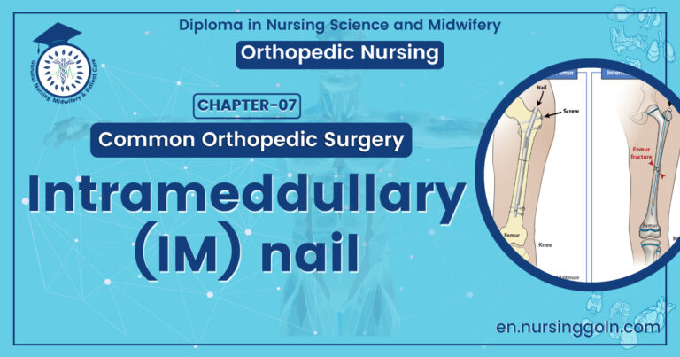 Intrameddullary (IM) nail