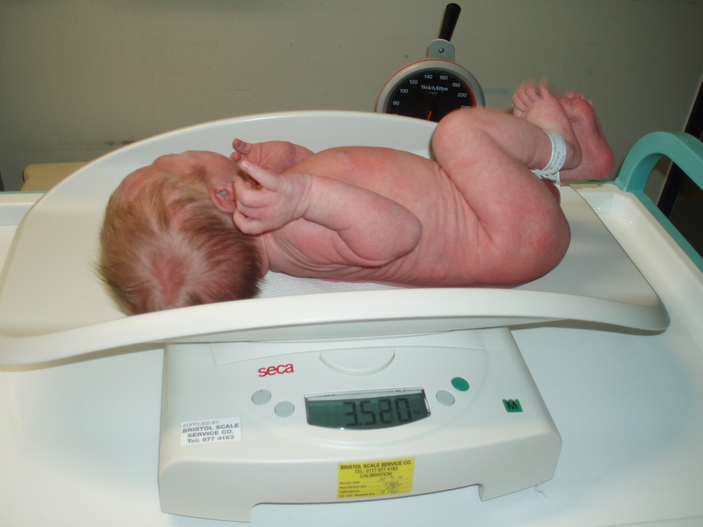 classification of Low birth weight (LBW)