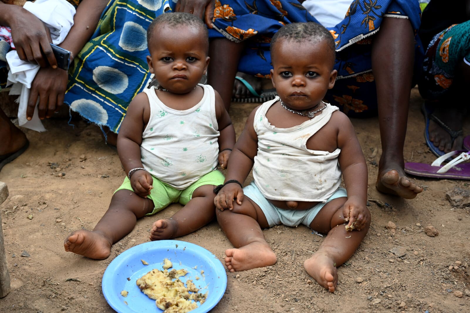 concept of malnutrition