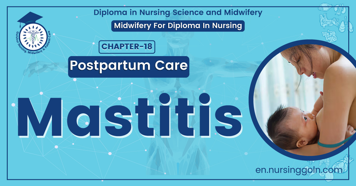 Concept about Mastitis