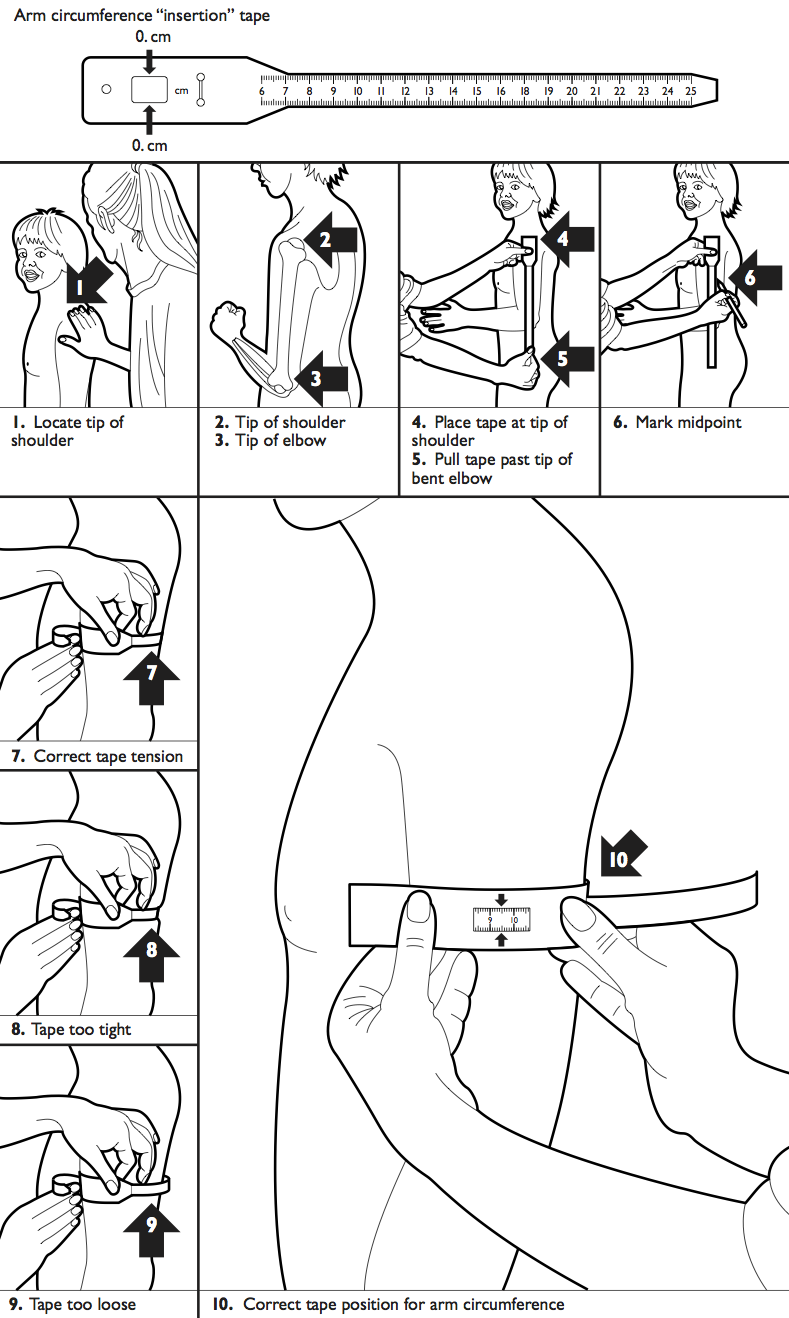 mid upper arm circumference