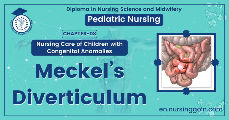 Meckels diverticulum | CHAPTER 8 | Pediatric Nursing