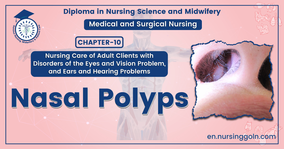 Nasal polyps | CHAPTER-10 | Medical and Surgical Nursing