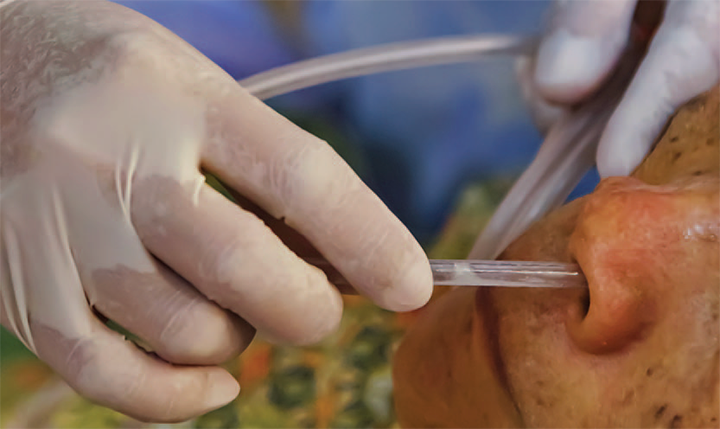 Concept of Nasogastric Tube | CHAPTER 8 | Nutrition and Dietetics