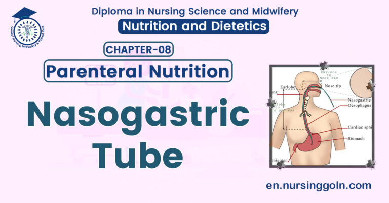 Nasogastric Tube