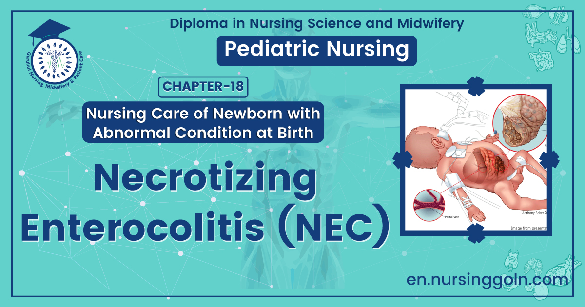 Necrotizing Enterocolitis (NEC) | CHAPTER 18 | Pediatric Nursing