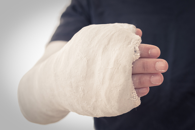 Plaster of Paris (POP) | CHAPTER 21 | Orthopedic Nursing