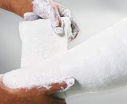 Plaster of Paris (POP) | CHAPTER 21 | Orthopedic Nursing