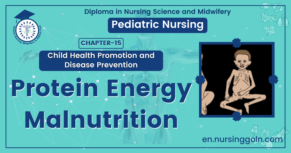 Protein Energy Malnutrition | CHAPTER 15 | Pediatric Nursing