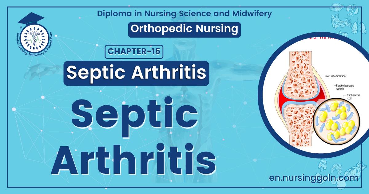 Septic arthritis | CHAPTER 15 | Orthopedic Nursing