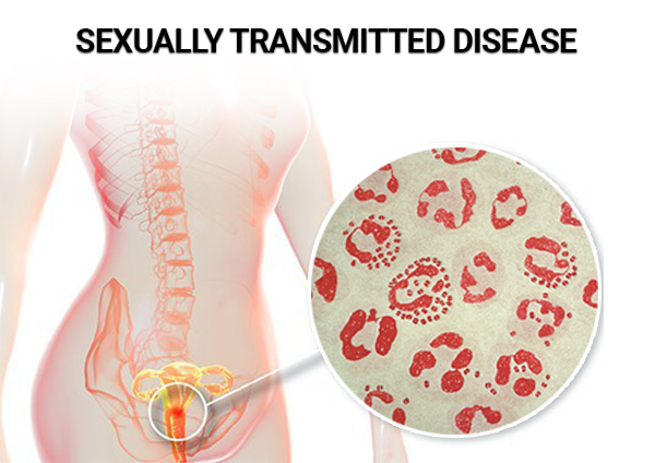 Sexually Transmitted Diseases (STDs) | Chapter 12 | Midwifery For Diploma In Nursing