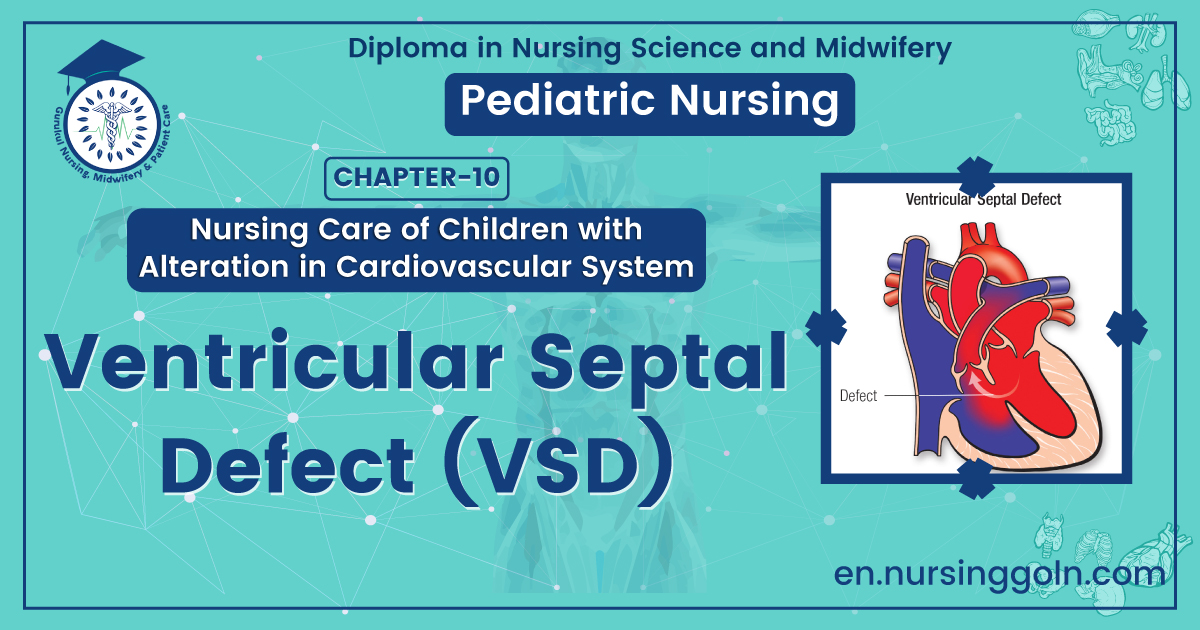Ventricular septal defect (VSD) | CHAPTER 10 | Pediatric Nursing