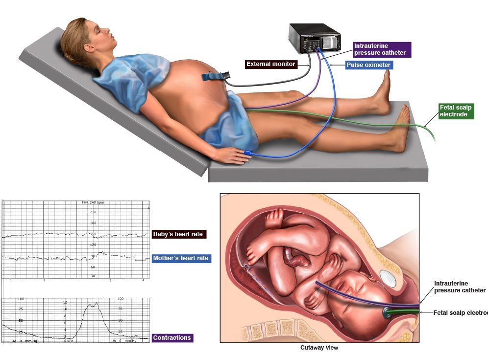 First Stage Of Labor | Chapter 13 | Midwifery For Diploma In Nursing