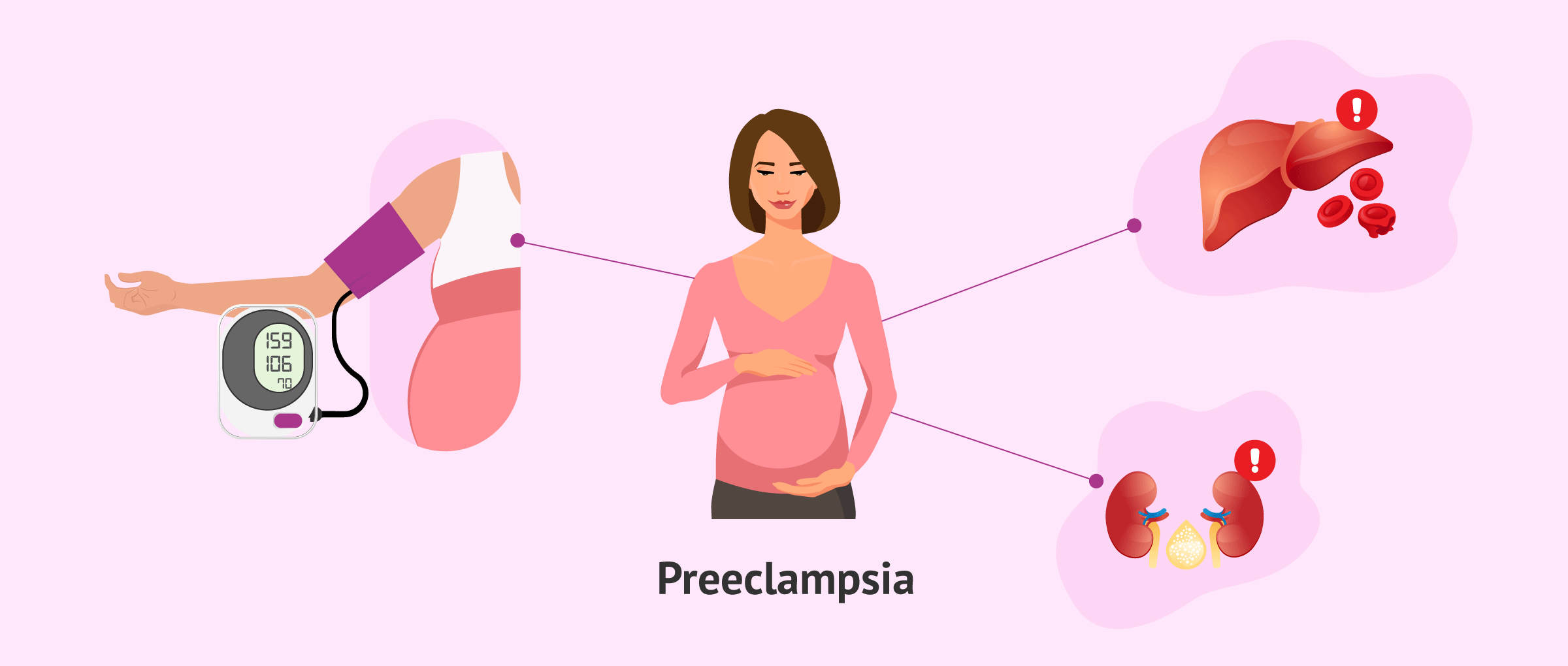 Pre-eclampsia | Chapter 10 | Midwifery For Diploma In Nursing