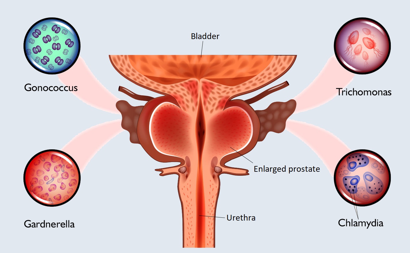 Sexually Transmitted Diseases (STDs) | Chapter 12 | Midwifery For Diploma In Nursing